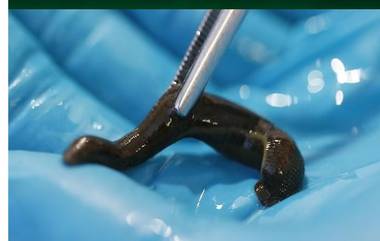 Doctors Remove Leech From Nose: రెండు వారాల పాటు యువకుడి ముక్కులో బతికి ఉన్న జలగ, రక్తం పీల్చుతున్నా కనిపెట్టలేకపోయిన యువకుడు, చివరకు ఏమైందంటే..