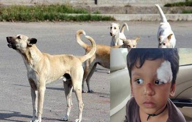 Dog Attack in Telangana: ఇంటిముందు ఆడుకుంటున్న బాలుడిపై వీధికుక్క దాడి, తీవ్ర గాయాలతో ఆస్పత్రి పాలైన చిన్నారి