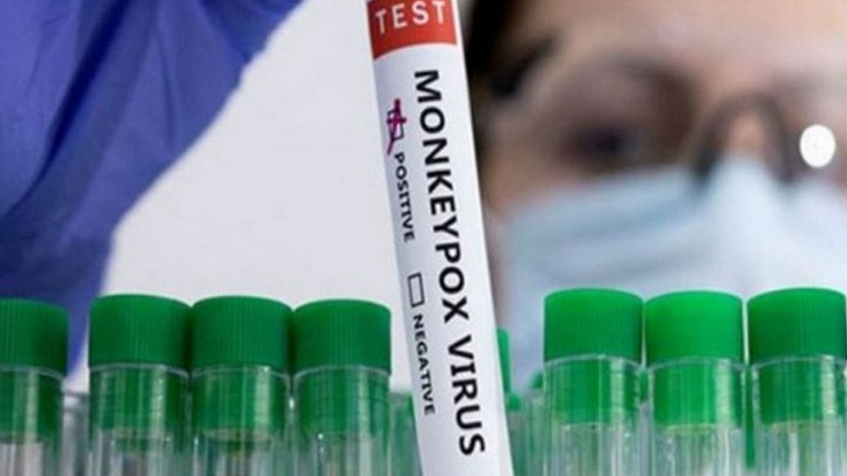 Mpox Alert: దేశంలో మంకీపాక్స్ క్లాడ్ 1బీ తొలి కేసు నమోదు, కేరళకు చెందిన 38 ఏళ్ల వ్యక్తికి వైరస్ నిర్ధారణ, ఇప్పటికే పబ్లిక్ హెల్త్ ఎమర్జెన్సీగా ప్రకటించిన డబ్ల్యూహెచ్‌ఓ