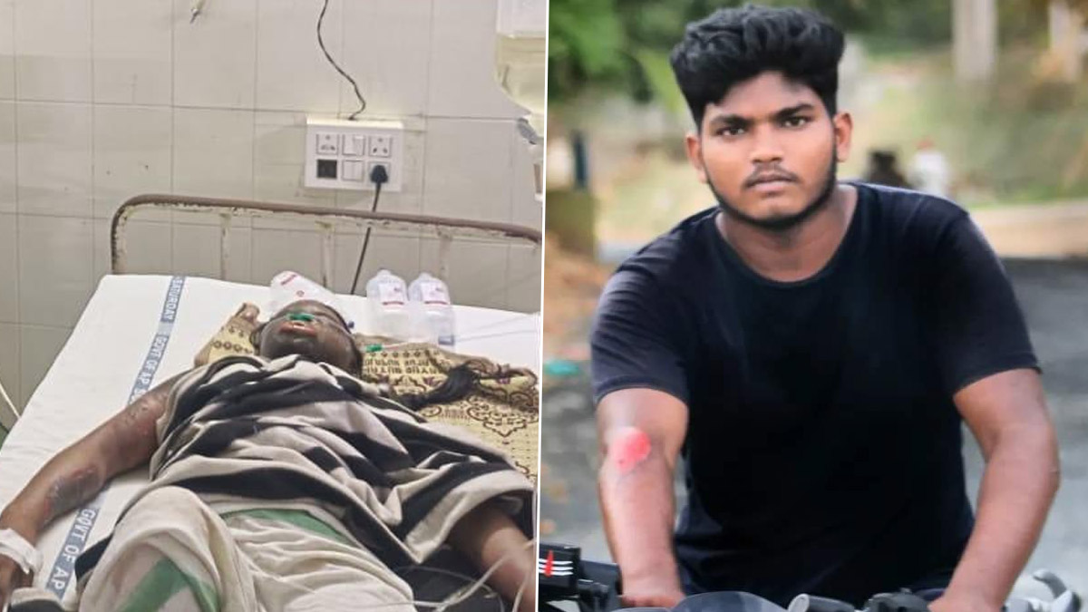 Badvel Horror Update: ప్రేమ పేరుతో విద్యార్థినిపై పెట్రోల్ పోసి నిప్పుపెట్టిన ఘటన..  చికిత్స పొందుతూ ఇంటర్ విద్యార్థిని మృతి.. పోలీసుల అదుపులో నిందితుడు