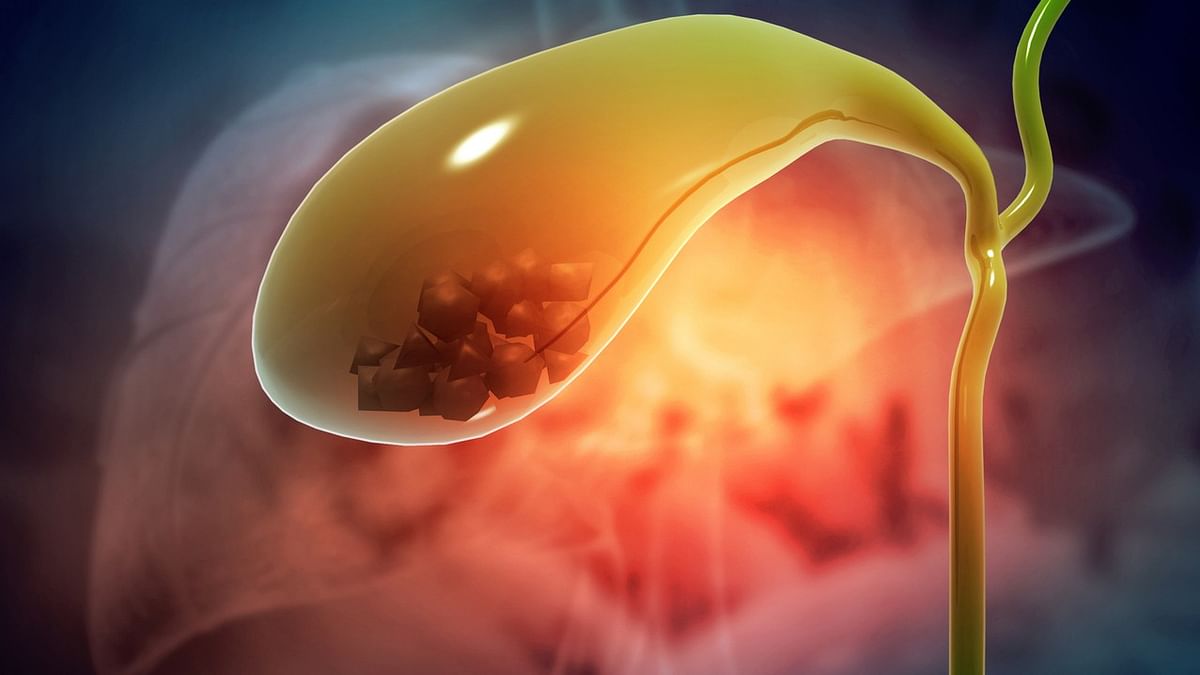 Health Tips: గాల్ బ్లాడర్ లో రాళ్ల సమస్య ఇబ్బంది పెడుతుందా..అయితే ఈ చిట్కాలతో ఈ సమస్యకు పరిష్కారం.
