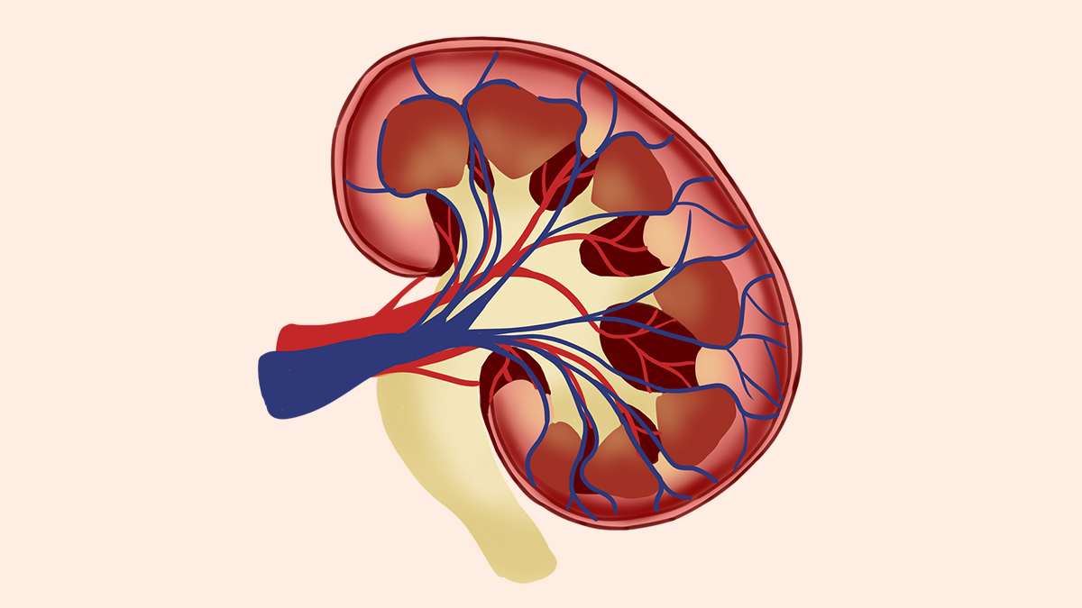 Health Tips: మూత్రపిండాల రాళ్ల సమస్యతో బాధపడుతున్నారా, అయితే ఈ రెమెడీస్ తోటి ఈ సమస్యకు పరిష్కారం..