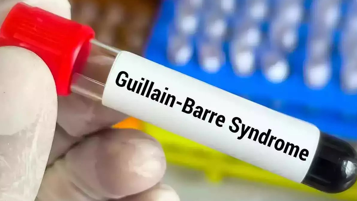 GBS Outbreak in Andhra Pradesh: ఏపీని వణికిస్తున్నజీబీఎస్, తాజాగా శ్రీకాకుళంలో యువకుడికి బ్రెయిన్ డెడ్, ఇద్దరి పరిస్థితి విషమం, అప్రమత్తమైన అధికారులు, గిలియన్-బార్ సిండ్రోమ్ లక్షణాలు ఇవిగో..