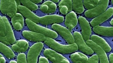 Vibrio vulnificus: ప్రజలను గజగజ వణికిస్తున్న కొత్త వైరస్.. అమెరికాలో రెండు కేసులు నమోదు.. ప్రాణాంతక బ్యాక్టీరియా విబ్రియో వల్నిఫికస్ గురించి పూర్తిగా తెలుసుకోండి