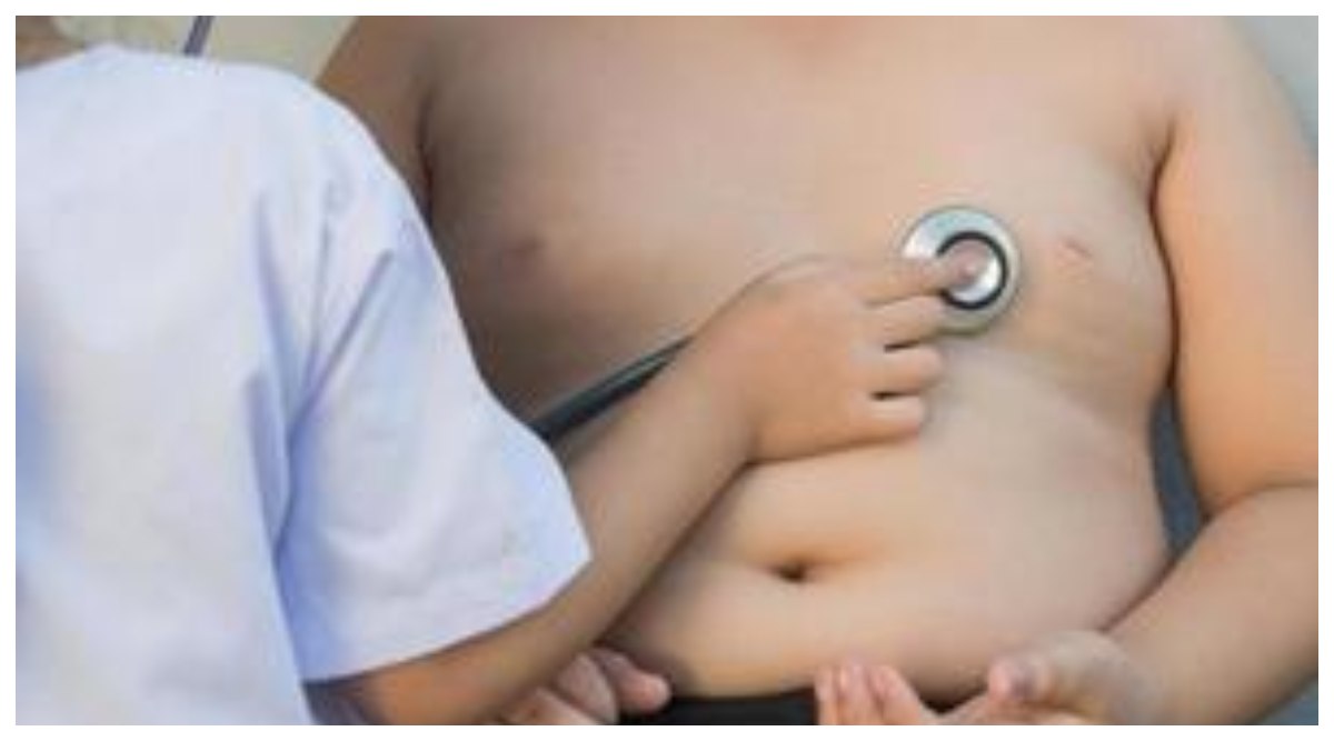 Obesity in Children: పిల్లల్లో ఊబకాయంపై షాకింగ్ రిపోర్ట్.. మధుమేహం, గుండె జబ్బులకు దారితీస్తున్న అధిక బరువు, తల్లిదండ్రులు మేలుకోకుంటే అంతే సంగతులు అంటున్న వైద్యులు