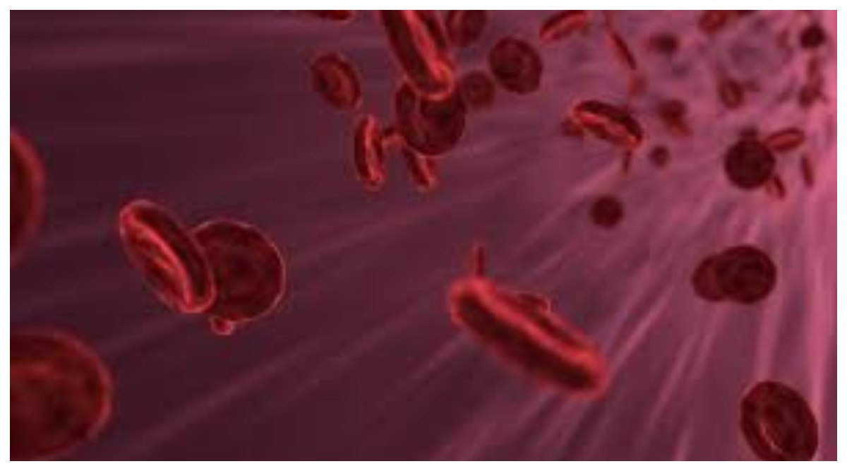 Early Signs of High Cholesterol: మీ శరీరంలో అధిక కొలెస్ట్రాల్ పేరుకుపోతే ఎలాంటి లక్షణాలు కనబడతాయి?, అధిక కొలెస్ట్రాల్‌కు కారణాలు ఏమిటి, ప్రధాన హెచ్చరిక సంకేతాలు ఎలా ఉంటాయి ?