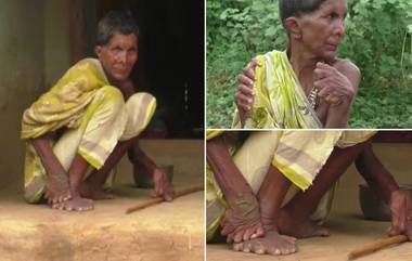 Women Born With 20 Toes And 12 Fingers: శాపంగా మారిన పుట్టుక లోపం, 20 కాలివేళ్లు, చేతులకి 12 వేళ్లతో జన్మించిన ఒడిశా మహిళ నయక్‌ కుమారి, మంత్రగత్తె అంటూ నిందలు, చేయానికి పాపానికి వివక్షకు గురవుతున్నానంటూ ఆవేదన