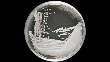 Candida Auris Fungus: మళ్లీ కరోనా కన్నా డేంజరస్ వైరస్, భారీ సంఖ్యలో మరణాలు సంభవించే అవకాశం, క్యాండిడా ఆరిస్‌ వస్తే బతికే అవకాశాలు తక్కువంటున్న శాస్త్రవేత్తలు, మానవాళి మళ్లీ సిద్ధంగా ఉండాలని హెచ్చరికలు