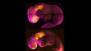 Synthetic Embryo: ప్రపంచ వైద్య చరిత్రలోనే తొలిసారి.. అండాలు, శుక్రకణాలు లేకుండా... మూలకణాలతో కృత్రిమ గర్భస్థ పిండం