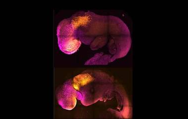 Synthetic Embryo: ప్రపంచ వైద్య చరిత్రలోనే తొలిసారి.. అండాలు, శుక్రకణాలు లేకుండా... మూలకణాలతో కృత్రిమ గర్భస్థ పిండం