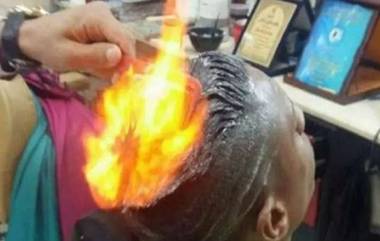 Fire Hair Cut Goes Wrong: వికటించిన హెయిర్ కటింగ్, తలకు నిప్పుపెట్టి కటింగ్ చేయించుకునేందుకు ప్రయత్నించిన యువకుడు, మెడ సహా మొహానికి గాయాలు, వైరల్‌గా మారిన ఫైర్ కటింగ్ వీడియో