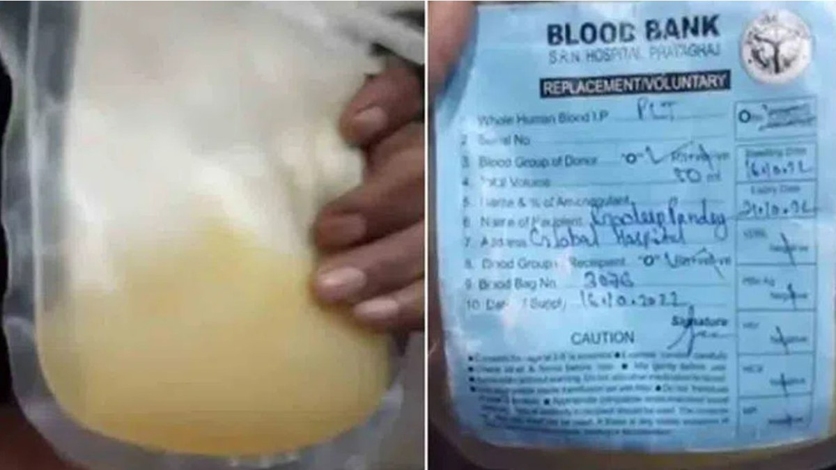 Mosambi Juice Instead of Plasma: డెంగీ రోగికి ప్లాస్మాకు బదులు బత్తాయిజ్యూస్‌ ఎక్కించిన సిబ్బంది, ఉత్తరప్రదేశ్‌ ఆస్పత్రి నిర్వాకం, పేషెంట్ మరణించడంతో విచారణకు ఆదేశించిన ప్రభుత్వం