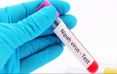 Nipah Virus: కేర‌ళలో మ‌రోసారి నిఫా వైర‌స్ క‌ల‌క‌లం, 14 ఏళ్ల బాలుడికి ప్రాణాంత‌క వైర‌స్ నిర్ధార‌ణ‌, ల‌క్ష‌ణాలు ఎలా ఉంటాయంటే?