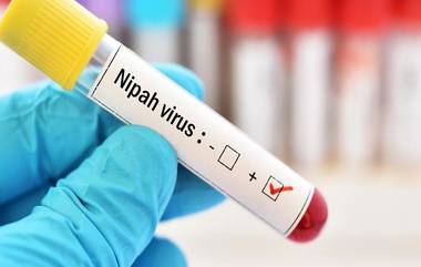 Nipah Virus: కేర‌ళ‌లో విజృంభిస్తున్న నిఫా వైర‌స్, 14 ఏళ్ల బాలుడి మృతితో కేంద్రం అల‌ర్ట్, ప్ర‌త్యేక బృందాన్ని పంపిన ఆరోగ్య‌శాఖ‌