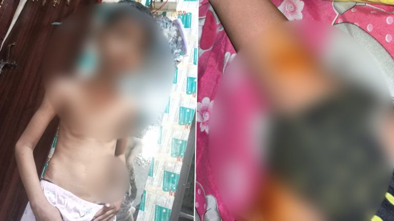 Dog Attack on Minor Boy: వీడియో ఇదిగో, మైనర్ బాలుడిపై దాడి చేసిన పిట్‌బుల్ డాగ్, కుక్క యజమానులను అదుపులోకి తీసుకున్న పోలీసులు